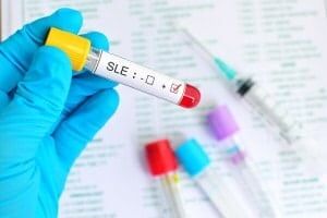 Qualifying for Social Security Disability with Lupus